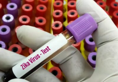 zika-virus-health